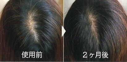 使用例写真：55歳 女性