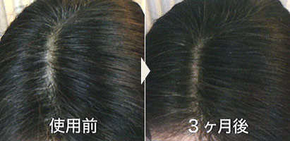 使用例写真：56歳 女性
