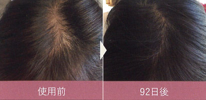 使用例写真